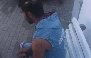 Χανιά: ξυλοδαρμός εργάτη από το αφεντικό